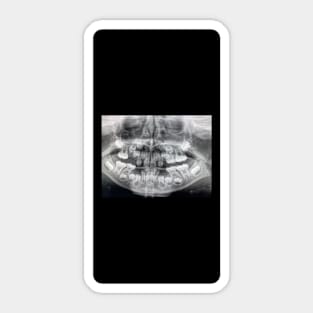 Dental x ray Sticker